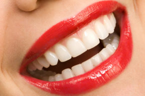 Dientes blancos y sonrisa impecable