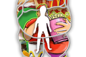 Cirugías como tratamientos contra la obesidad