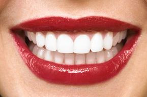 Algunos consejos para tener los dientes blancos
