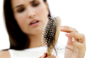 La alopecia femenina