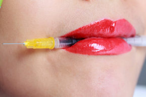 Labios carnosos con cirugía estética