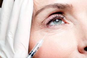 El botox, la alternativa ideal de la cirugía