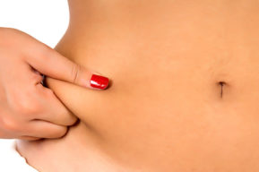 La lipoaspiración para eliminar la grasa sobrante