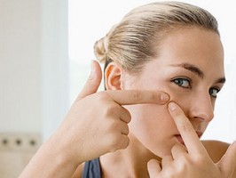 Diez tips para evitar el acné