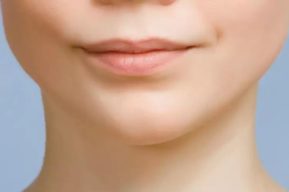 Cirugía de perfil facial para dar armonía a tu rostro
