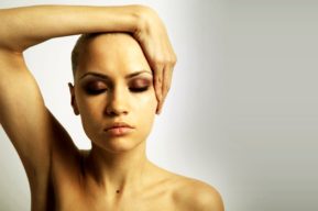 La alopecia femenina, cómo afecta y qué soluciones hay