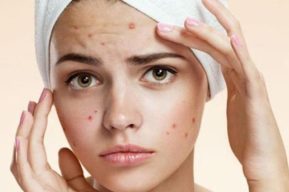 Cómo eliminar las manchas de la piel de la cara