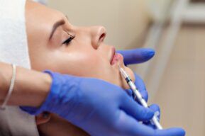 Tratamientos estéticos sin cirugía: del lip lift al ácido hialurónico